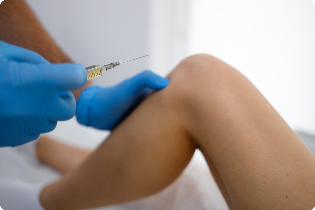 Beneficiile Infiltrațiilor cu Acid Hialuronic